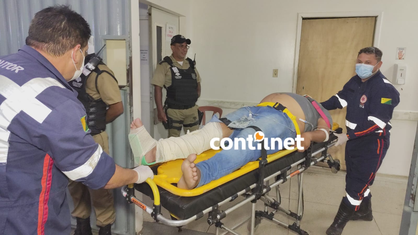 Motorista de aplicativo sofre fratura exposta após colisão com carro conduzido por padre em Rio Branco